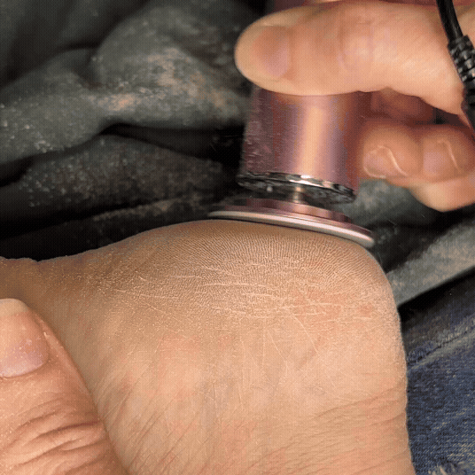 ⭐ SmoothSkin Pro – Elektrischer Hornhautentferner für seidig weiche Füße in Sekunden