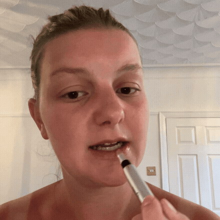 Sichtbar vollere Lippen. Sofort.