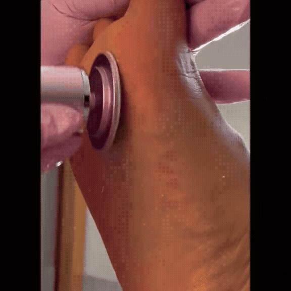 ⭐ SmoothSkin Pro – Elektrischer Hornhautentferner für seidig weiche Füße in Sekunden