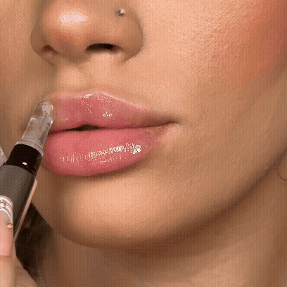 Sichtbar vollere Lippen. Sofort.